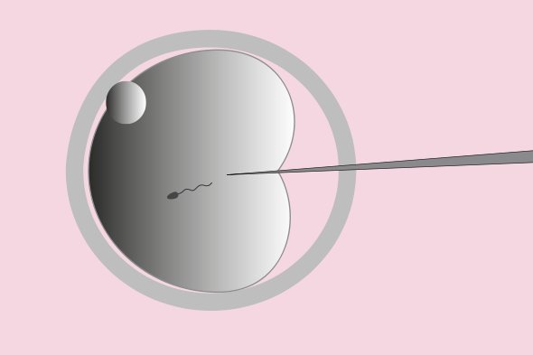 Befruktning med mikroinjektion (ICSI) Befruktning med mikroinjektion (ICSI)