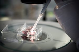 NordicIVF_juni-17_B88A1697